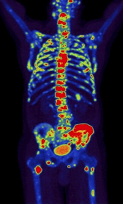 skeleton