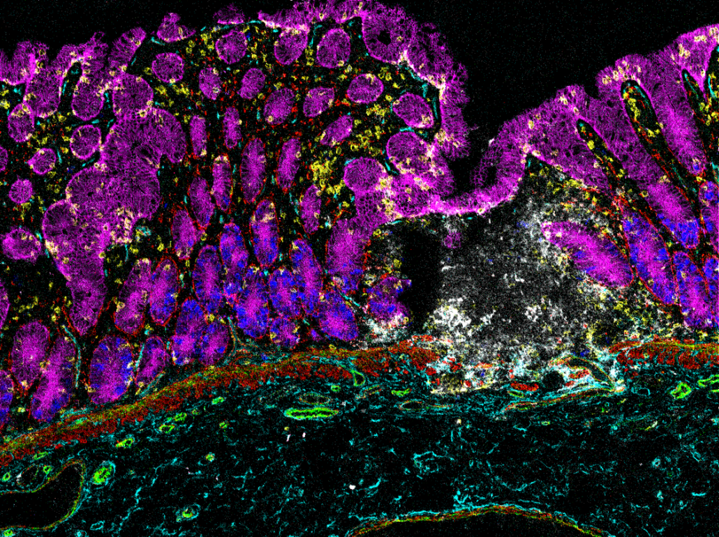 soCRC Colourful histological image showing different cell types.