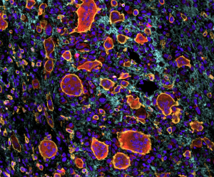 5. Carmen Rodriguez -CR_CRUK Image competition_2025 – copy – resized for wordpress