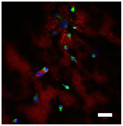 3D TME models (2) Image of CD68-positive iPS-derived macrophages (green) and fibronectin (red), deposited in stromal compartment of the model. Nuclei are stained in blue